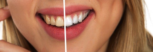 Denti ruvidi: quali sono le principali cause e che tipi di rimedi si possono utilizzare?
