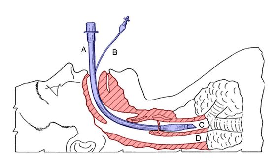 trachea